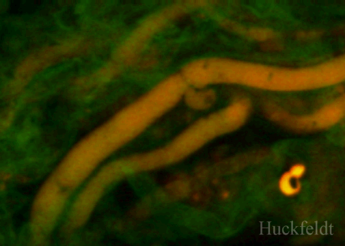 klicken um ein Bild zur&uuml;ck zu kommen