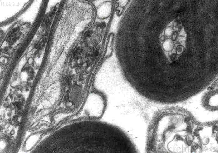Elektronenmikroskopisches Bild von Faserhyphen im Querschnitt