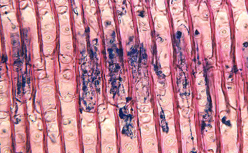 Mikroskopisches Bild von Hyphen des Hausschwammes im infiziertem Kiefernholz