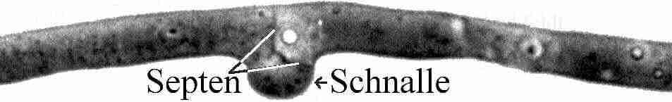 lichtmikroskopische Phasenkontrast-Aufnahme einer Hyphe des Echten Hausschwammes - mehr