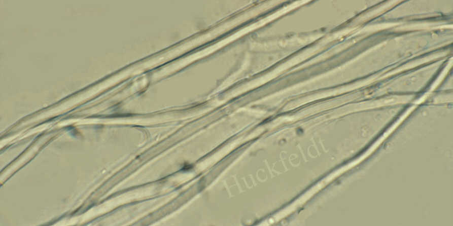 Mikroskopisches Bild von Faserhyphen