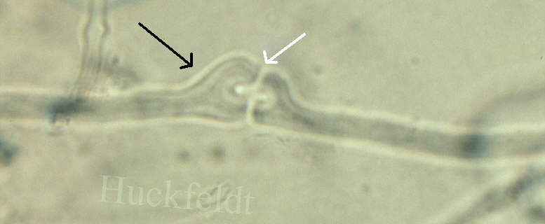 Mikroskopisches Bild von Faserhyphen