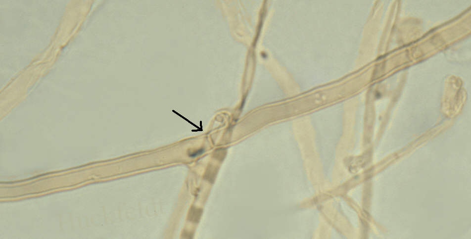 lichtmikroskopische Aufnahme einer Grundhyphe des Marmorierten Kellerschwammes (Coniophora marmorata)