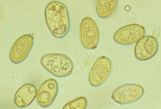 Sporen des Kellerschwammes