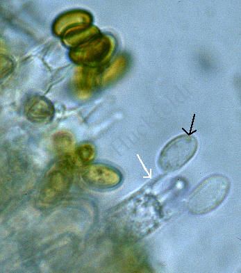 Hymenium im mikroskopischen Bild