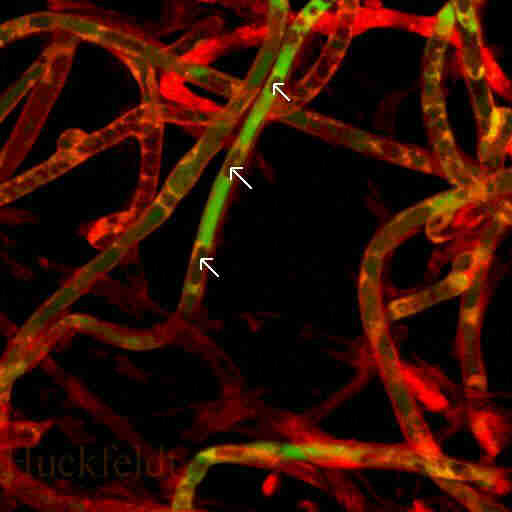 Grundhyphen von Serpula lacrymans im mikroskopischen Bild