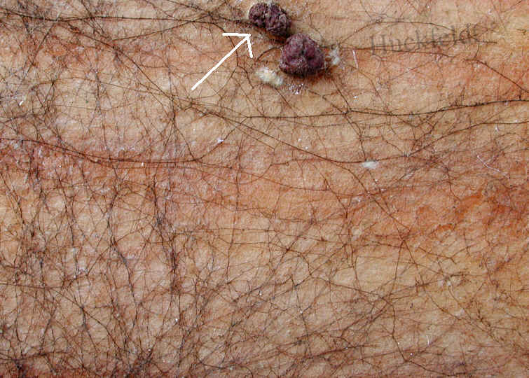  Str&auml;nge des Sklerotien Hausschwammes (Leucogyrophana mollusca)